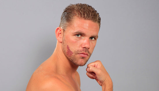 Billy Joe Saunders