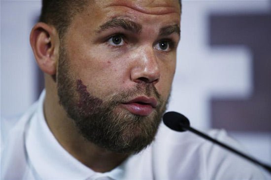 Billy Joe Saunders Vows To ‘Slap Slap Slap’ Mad Max Bursak On April 30 - Queensberry