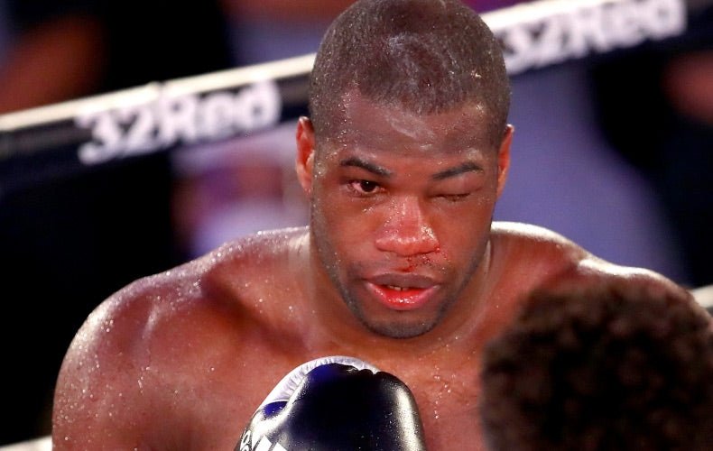 Exclusive: Daniel Dubois First Interview Since Joyce Fight - Queensberry